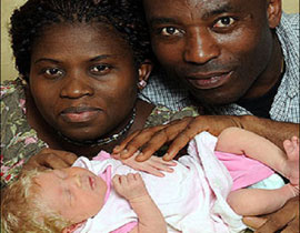 ولادة استثنائية: طفلة بيضاء بعينين زرقاوين لوالدان أسودان! 