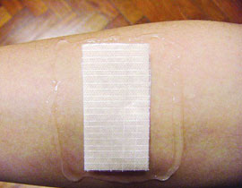 الثلج يعيق التئام الجروح!!