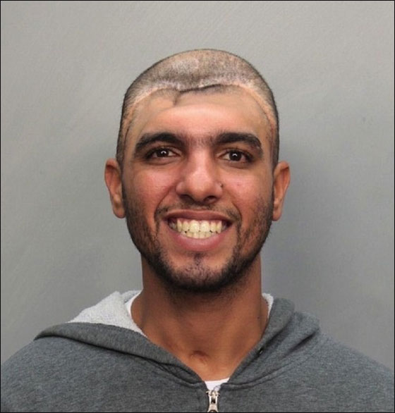 مجرم علامته المميزة انه بـ