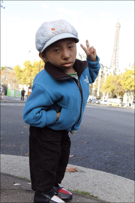 بالصور.. أصغر رجل في العالم بجولة مدهشة في باريس!! بالصور.. أصغر رجل في العالم بجولة مدهشة في باريس!!