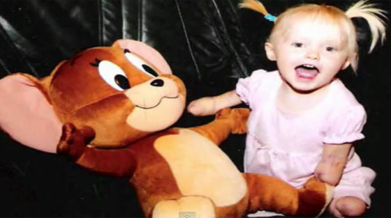 طفلة مبتورة الارجل والايدي تنضم لفريق كرة القدم بمدرستها!! طفلة مبتورة الارجل والايدي تنضم لفريق كرة القدم بمدرستها!!