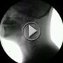 ����� X-Ray ���� ����� ��� �� ������� ����� ��� ������